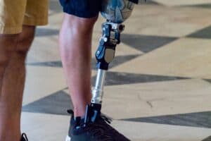 Amputações por Máquinas Verdes: Riscos em Energias Renováveis em 2025