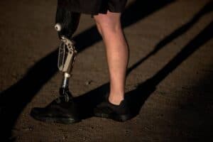 Perda de Membros em Saúde Ocupacional: Impactos Econômicos de R$ 350 Bilhões Anuais